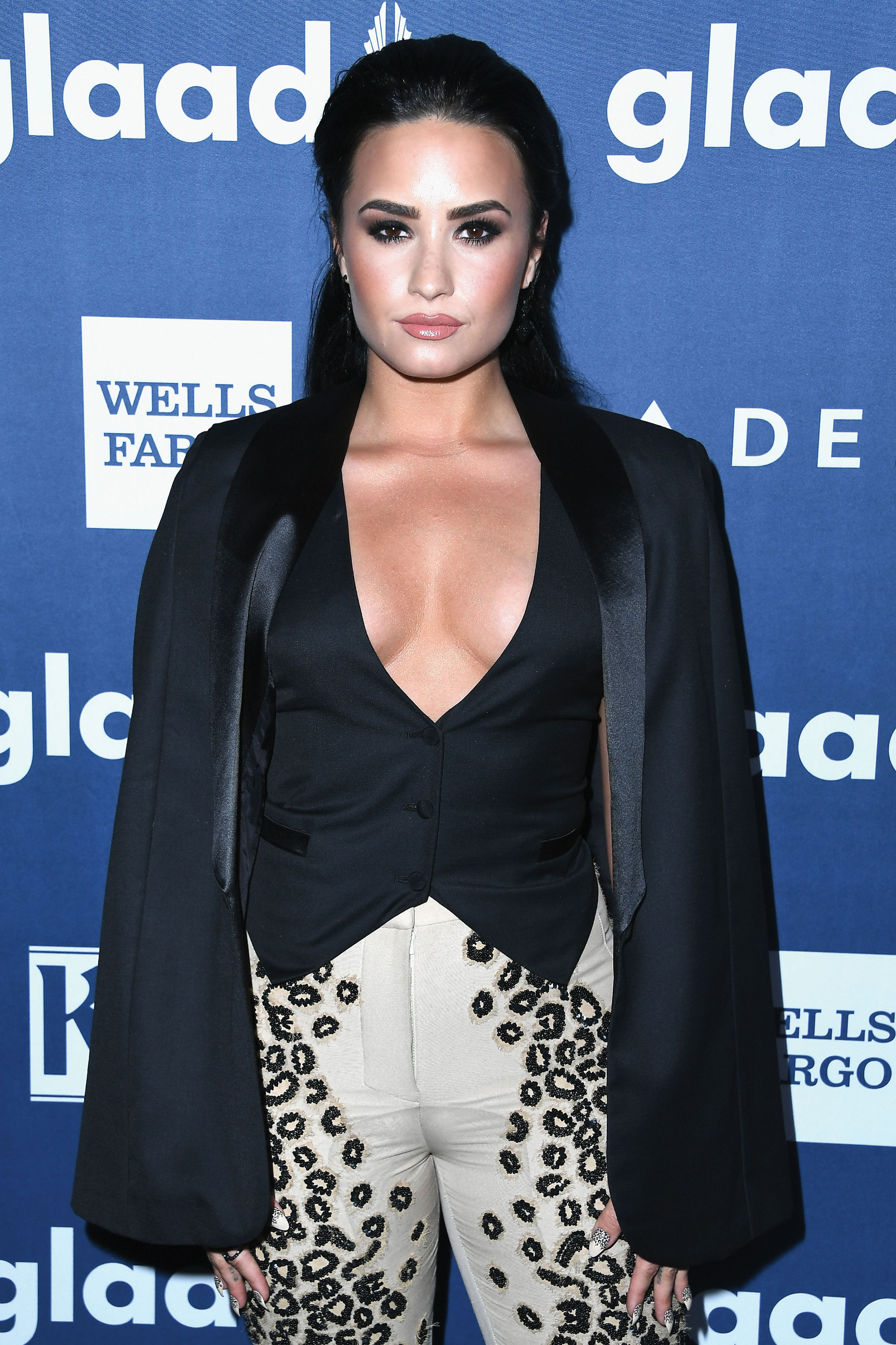 BEVERLY HILLS, CALIFORNIA - APRIL 02:  Honoree Demi Lovato attends the 27th Annual GLAAD Media Awards at the Beverly Hilton Hotel on April 2, 2016 in Beverly Hills, California.  (Photo by Steve Granitz/WireImage)
